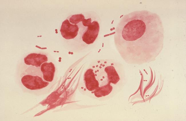 I batteri della gonorrea (Neisseria gonorrhoeae)